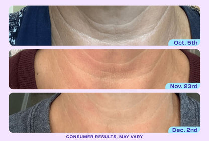 Tighten & Lift Neck Cream