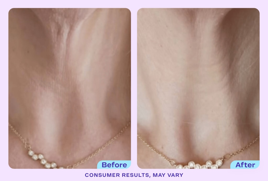 DermaLift™ - Tighten & Lift Neck Cream