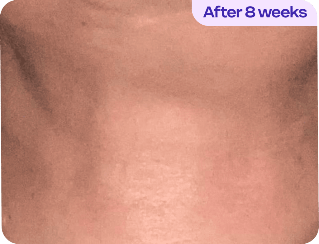 Tighten & Lift Neck Cream