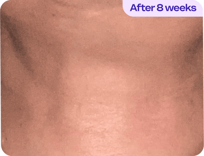 Tighten & Lift Neck Cream