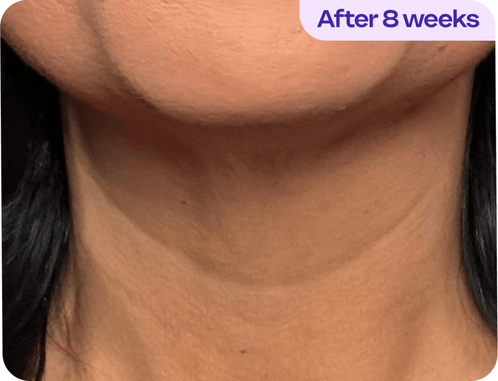 Tighten & Lift Neck Cream