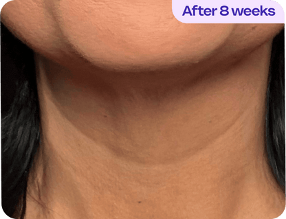 Tighten & Lift Neck Cream
