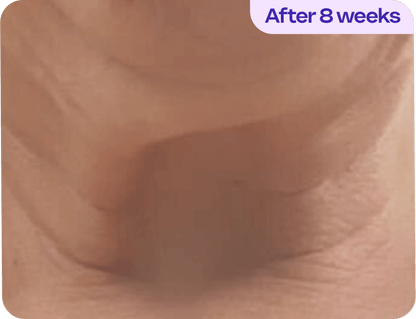 Tighten & Lift Neck Cream