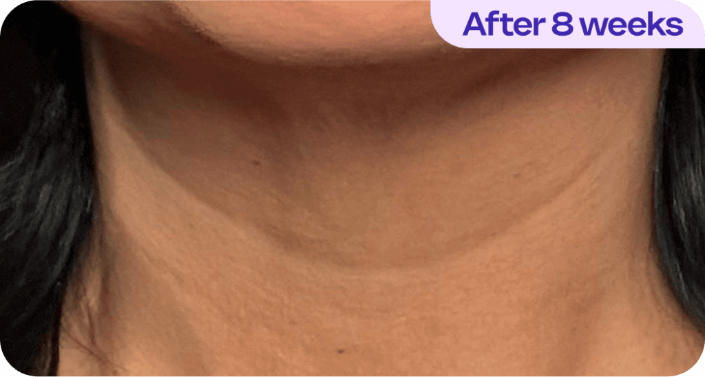 Tighten & Lift Neck Cream