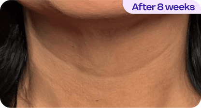 Tighten & Lift Neck Cream