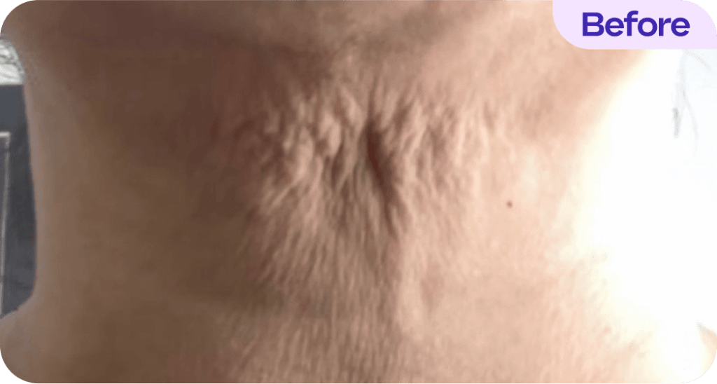 Tighten & Lift Neck Cream