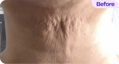 Tighten & Lift Neck Cream