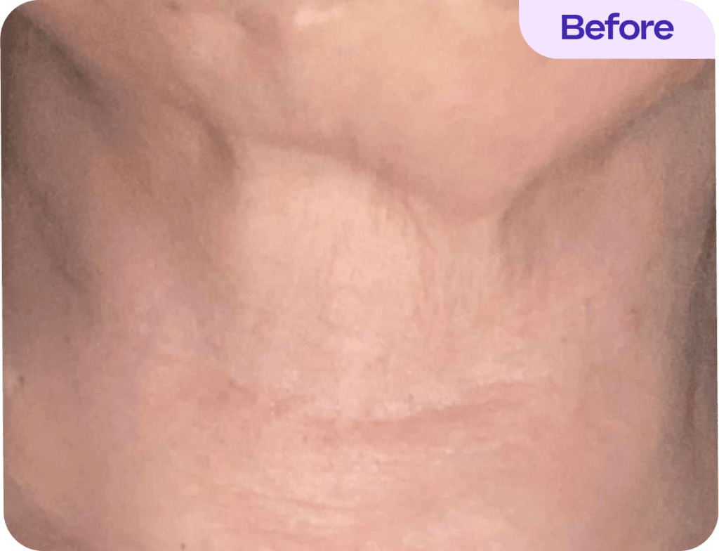 Tighten & Lift Neck Cream