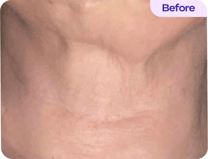 Tighten & Lift Neck Cream