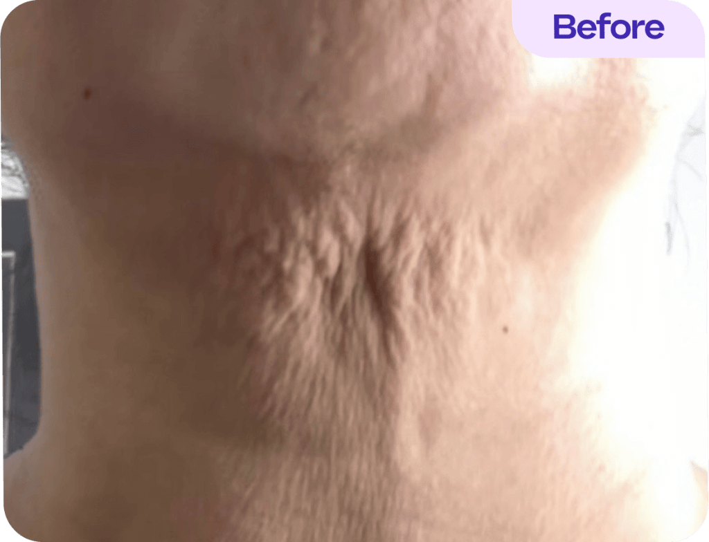 Tighten & Lift Neck Cream