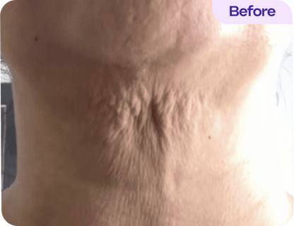 Tighten & Lift Neck Cream