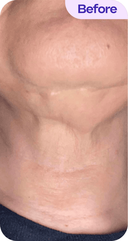 Tighten & Lift Neck Cream