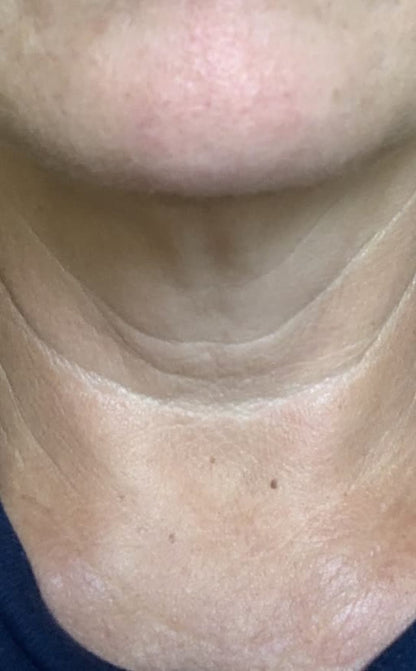 Tighten & Lift Neck Cream