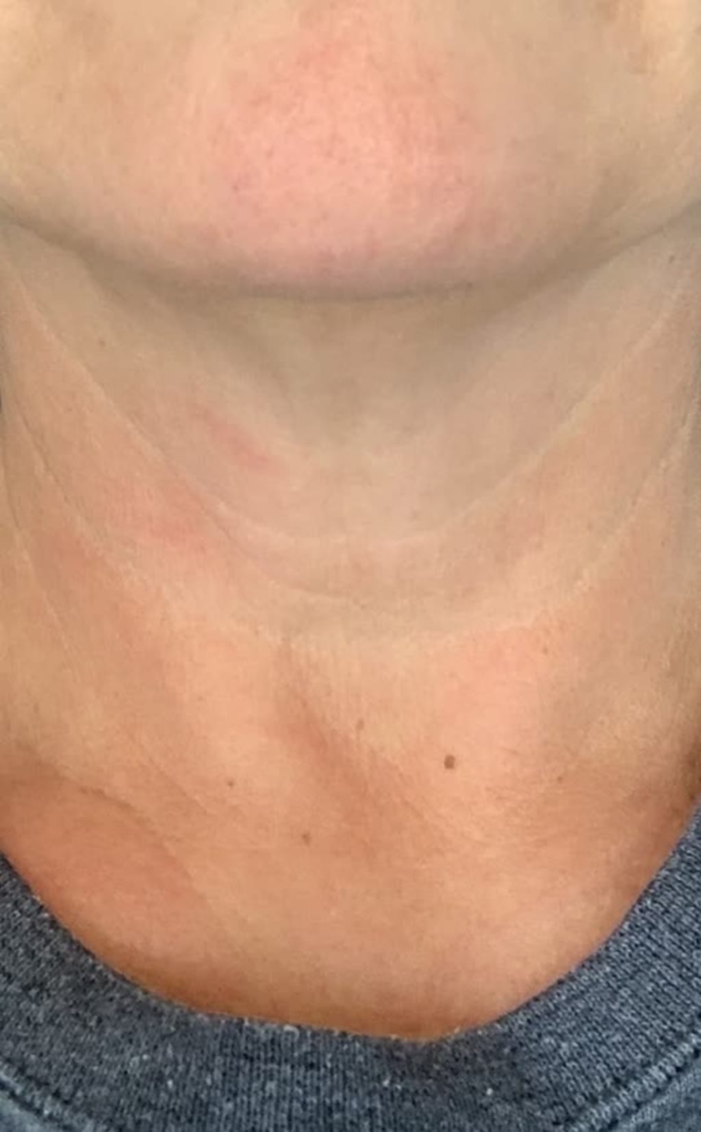 Tighten & Lift Neck Cream