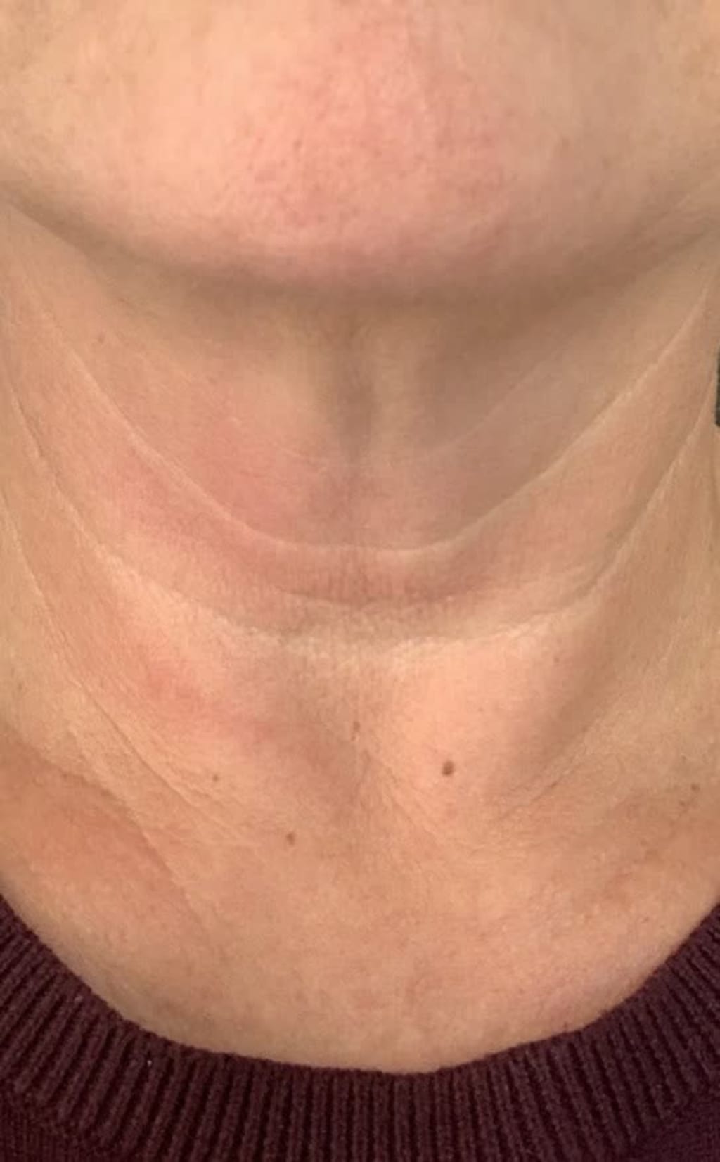 Tighten & Lift Neck Cream