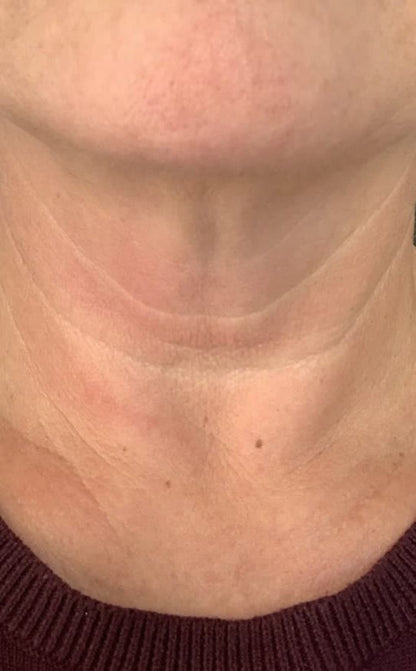 Tighten & Lift Neck Cream